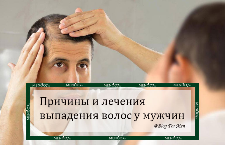 Причины и лечения выпадения волос у мужчин