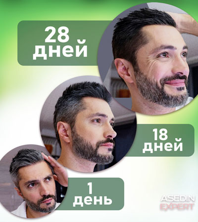 Лосьон восстановитель естественного цвета волос ASEDIN EXPERT Men's Series Сила 7 трав 200 мл