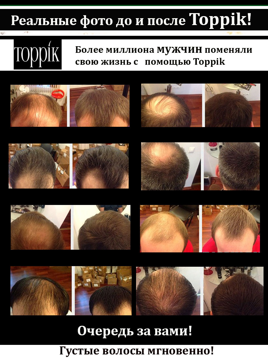 Камуфляж для волос и бороды Toppik сет №2 (2 в 1)